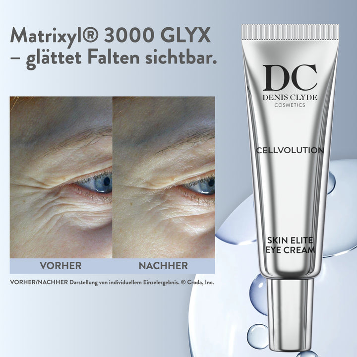 Skin Elite Eye Cream